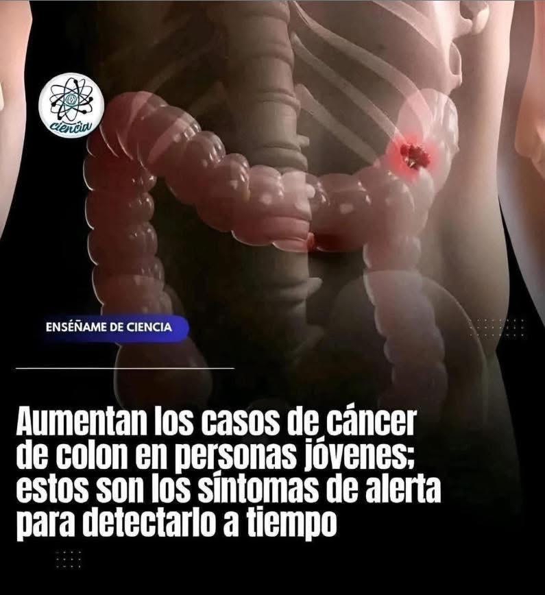 Síntomas de Cáncer de Colon