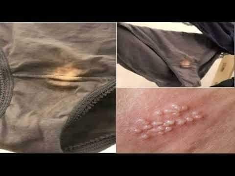 Manchas en ropa interior