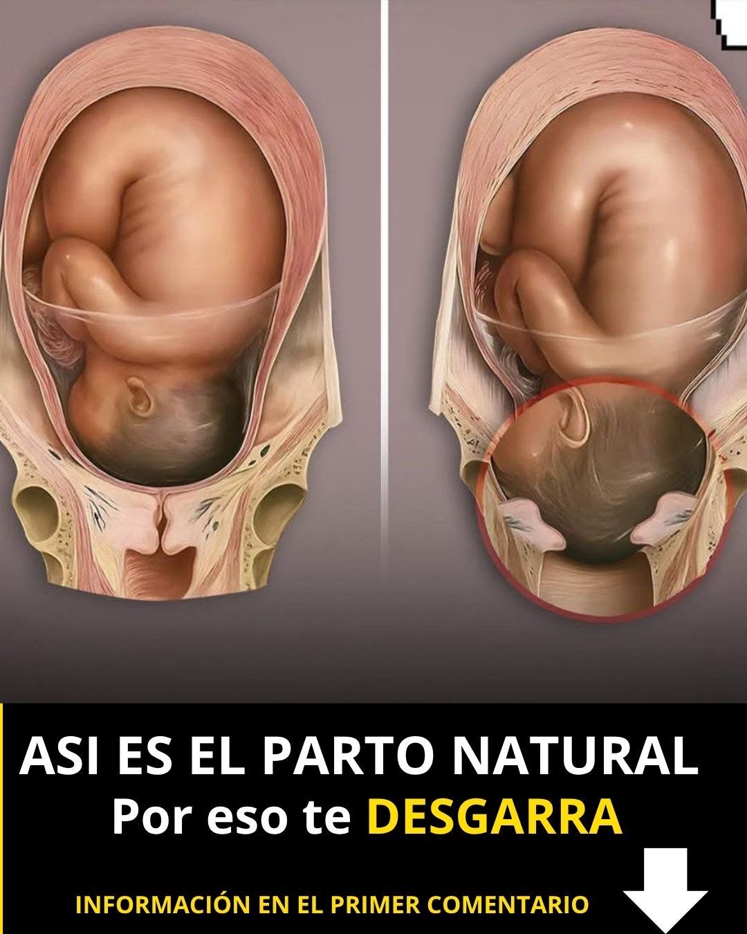 Ilustración de parto natural