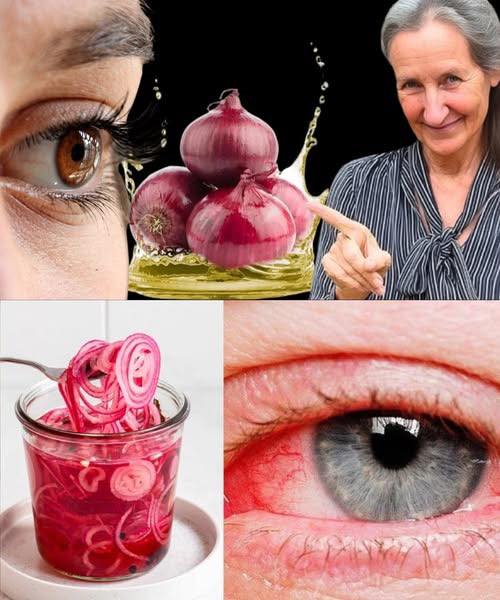 Beneficios de la cebolla para la salud ocular