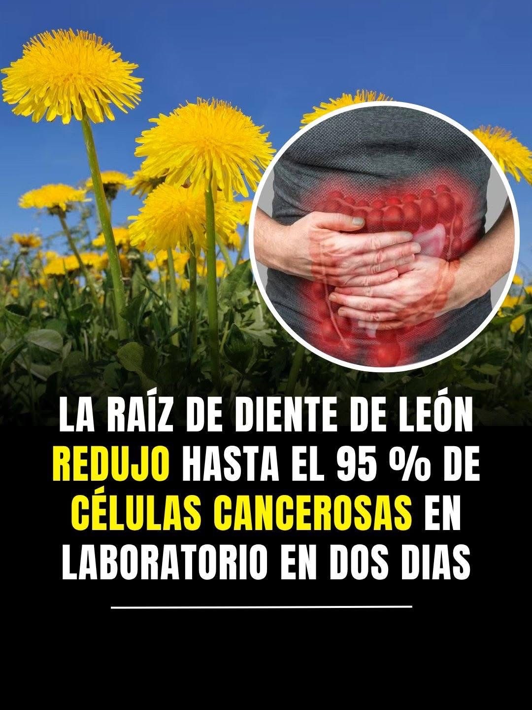 Flores de Diente de León