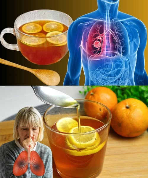 Jarabe Casero para aliviar la tos y la gripe