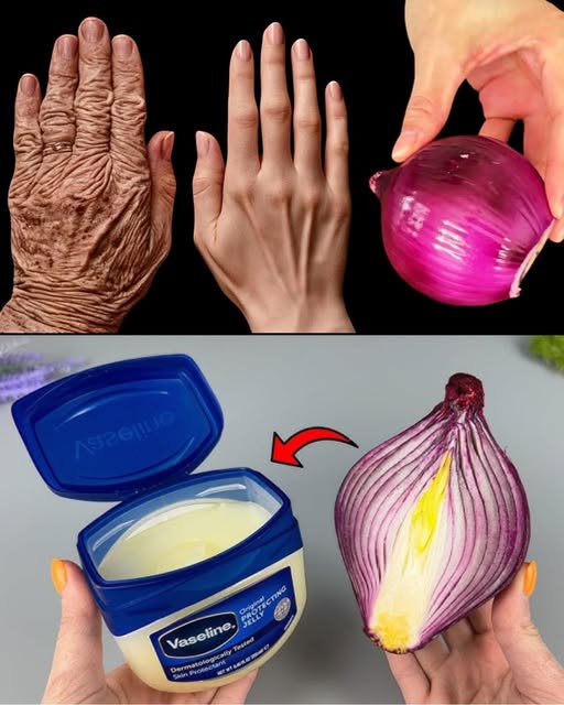 Cebolla roja y vaselina para el cuidado de la piel