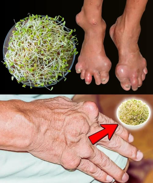 Remedios naturales con planta medicinal