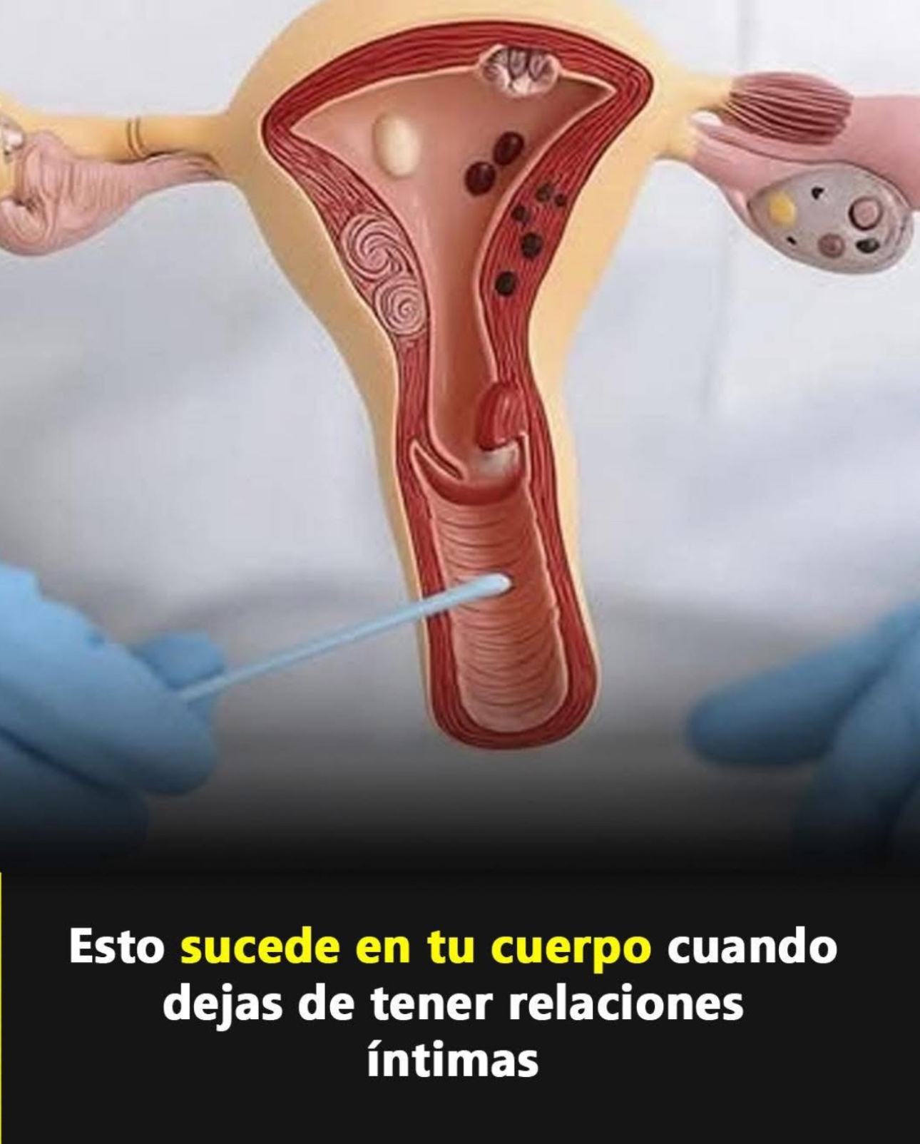 Modelo anatómico del aparato reproductor femenino