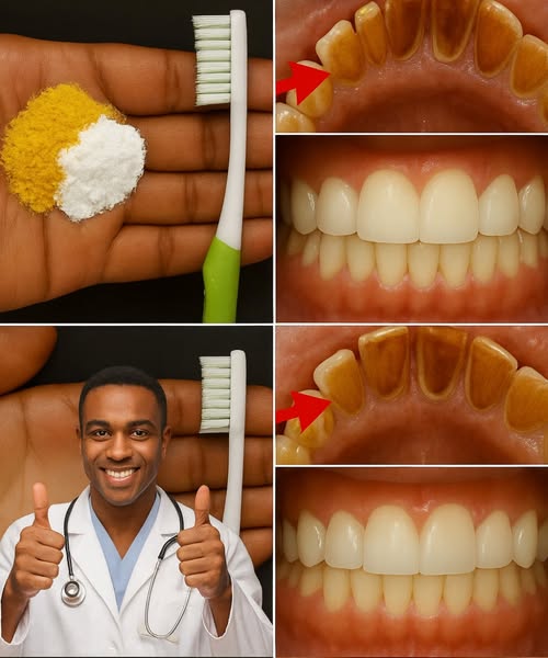 Blanqueamiento dental en casa con cúrcuma y bicarbonato de sodio