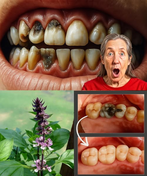 Albahaca Sagrada para la Salud Bucal