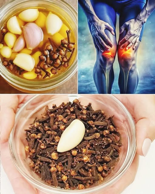 Preparación de ajo y clavos de olor