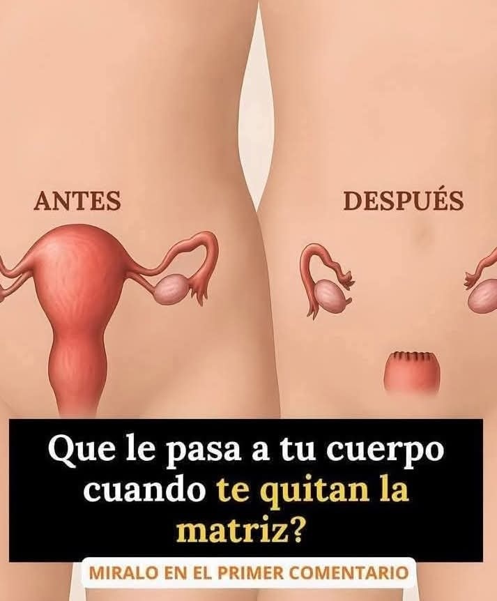 Cambios en el cuerpo femenino tras una histerectomía