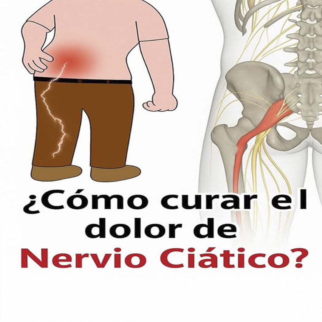 Dolor del nervio ciático