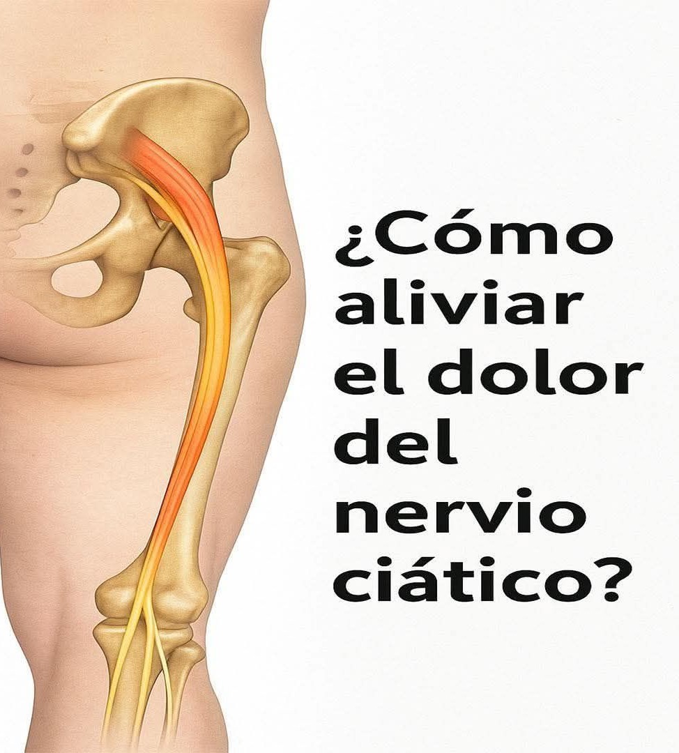 Alivio del dolor ciático