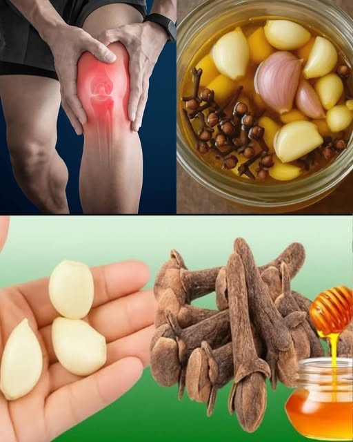 Remedio Natural para el Dolor de Piernas