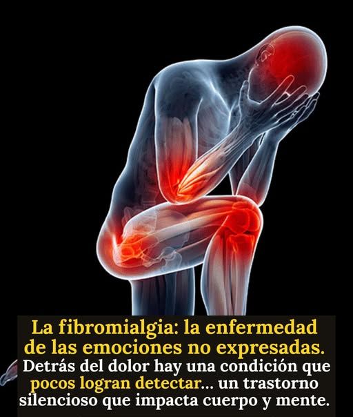 Representación 3D de la fibromialgia