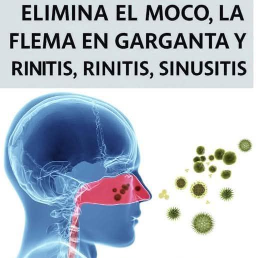 Gráfico de problemas respiratorios: Moco, Flema, Rinitis y Senos Paranasales