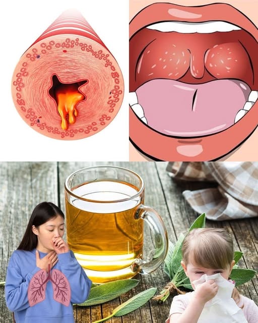 Remediar la Mucosidad