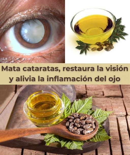 Remedio Natural para Cataratas