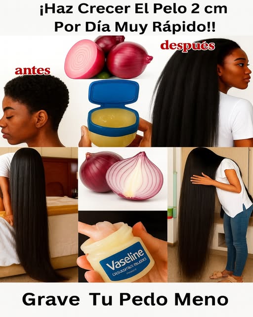 Cebolla y Vaselina para el Crecimiento del Cabello