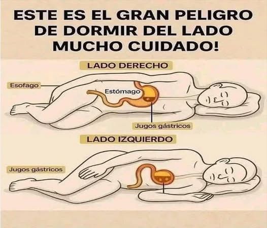 Ilustración de los efectos de dormir en diferentes lados