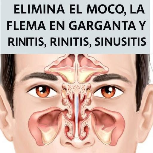 Gráfico Anatómico de los Senos Paranasales