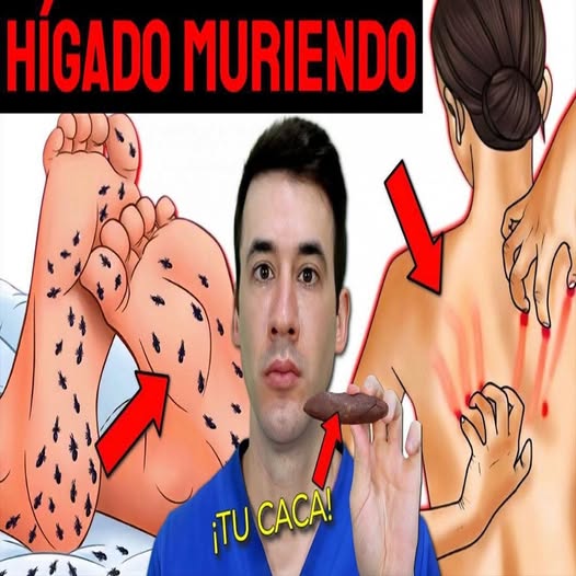 Síntomas de daño hepático