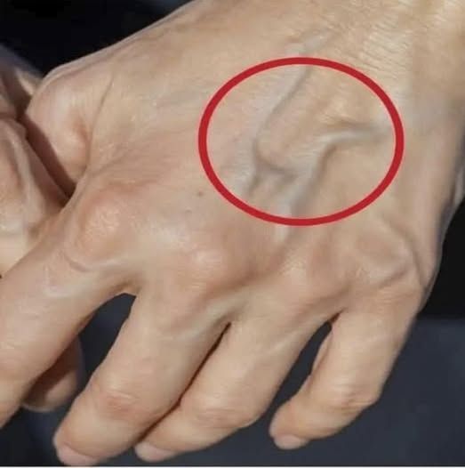 Venas visibles en las manos