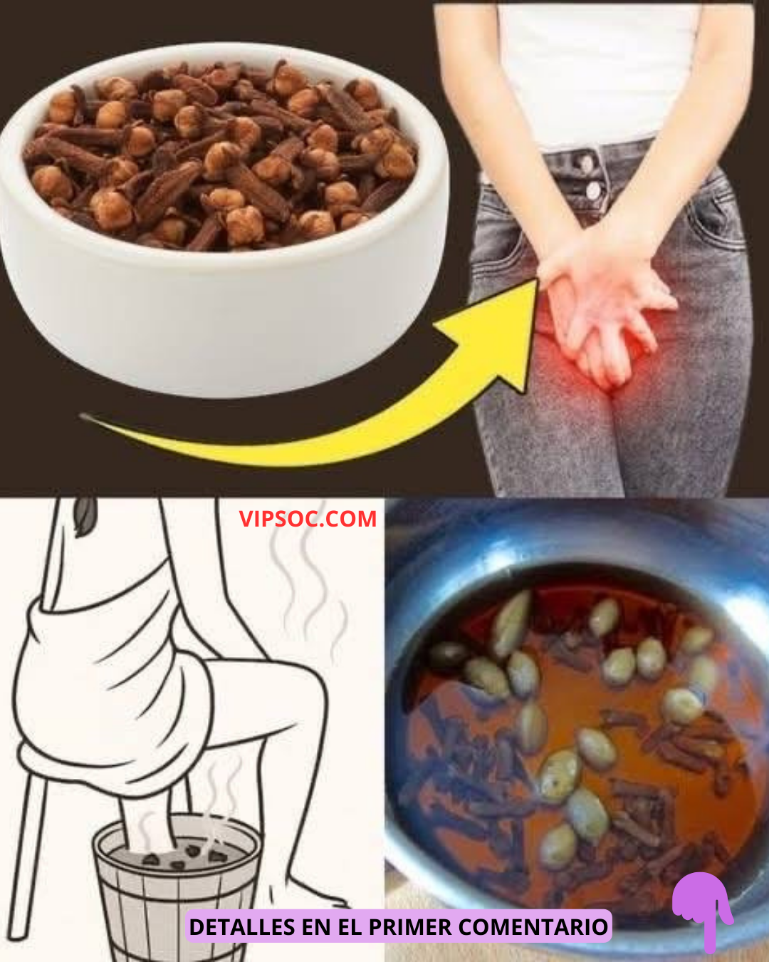 Usos del clavo de olor en remedios caseros