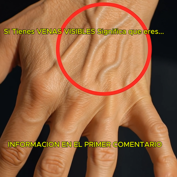 Venas Visibles en Mano