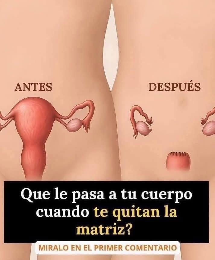 Comparativa del cuerpo antes y después de una histerectomía