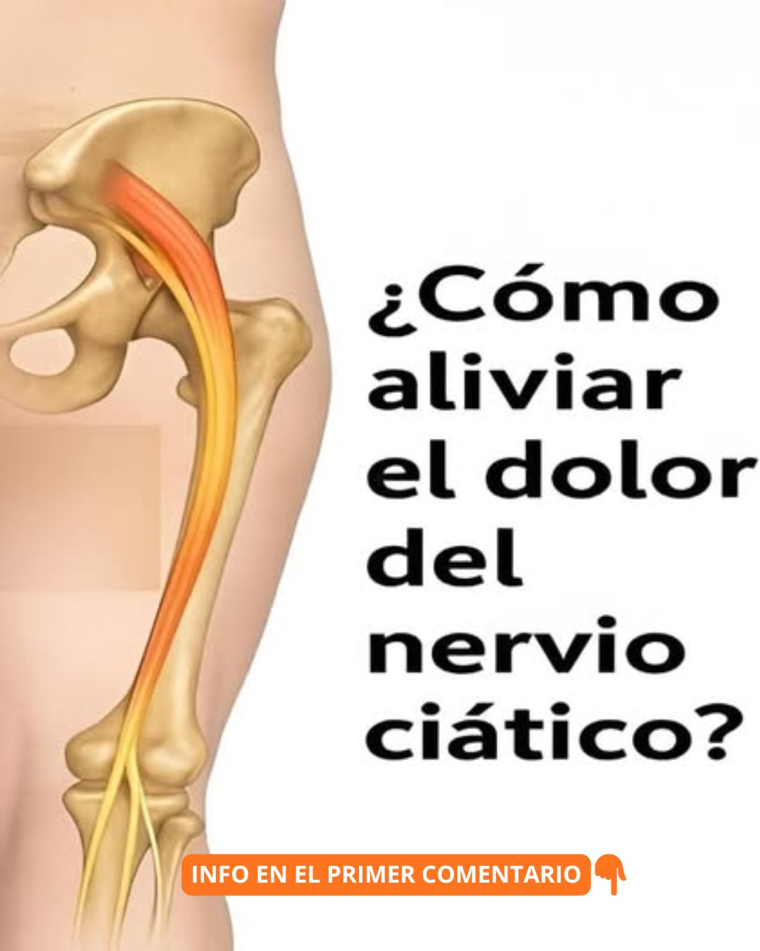 Recorrido dorsal del nervio ciático